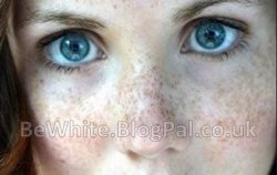 Natural skin whitening cream for Africans