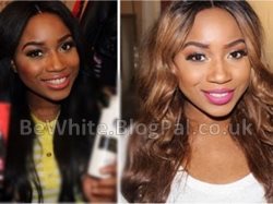 Skin whitening natural for Trinidadians men