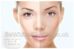 Bleaching neck creams for Congo