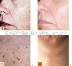 Body whitening lotion for Malawian women