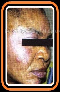 Best skin lightening creams for Uganda