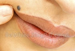 Facial whitening for Ugandan woman