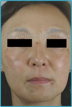 Natural skin lightener for Nigerian women