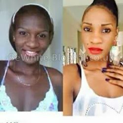 Face whitening cream for Somali people