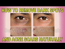 Safe skin lightening products for Zimbabwe women