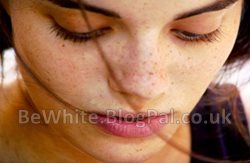 Skin bleaching lotion for Uganda women