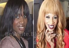 Facial bleaching cream for Black