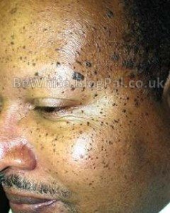 Best skin bleaching for Pakistani woman