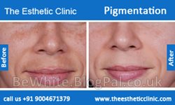Best whitening night cream for Malaysian men