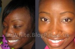 Revitol skin brightener for Zambia