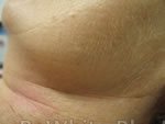 Body cream whitening for Uganda woman