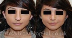 Skin brightening cream for Africans men