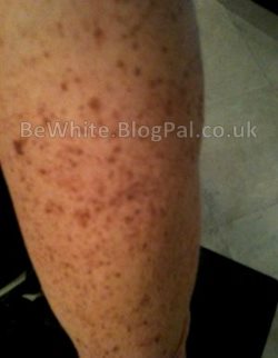 Skin lightening serum for Africans women