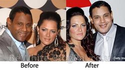Facial whitening for Zambia