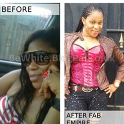 Whitening arm cream for Zimbabwean