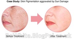 Natural whitening skin for Somalian woman