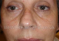 What is the best whitening cream for Jamaican woman