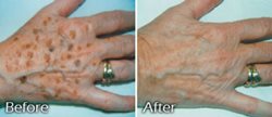 Ageing creams for Somalia woman