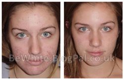 Ageing cream for Pakistani woman