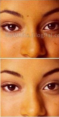 Best lightening creams for Black Africans men