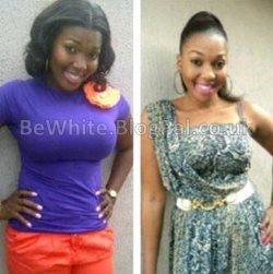 Facial bleaching cream for Malawi people