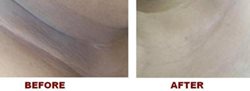 Whitening skin creams for Malawian men