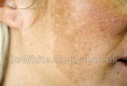 Best skin lightening cream for Zimbabwean woman