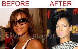 Whitening black skin cream for Nigerian woman