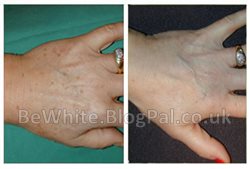 Face whitening cream for Ghanaian people