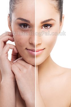 Best lightening creams for Ghanaian