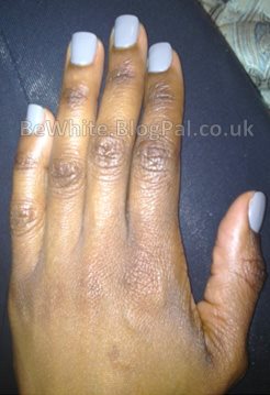 Kojic acid products for Ghanaian woman