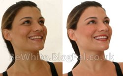Face whitener for Malawian women