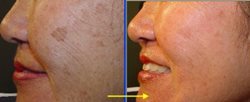 Facial whitening cream for Thai