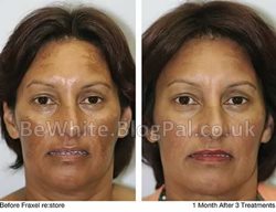 Bleaching neck cream for Zambia