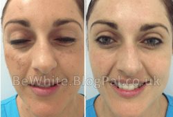 Whitening cream face for Black Africans people