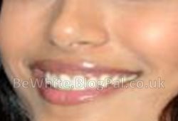 Best whitening cream in the world for Somali woman