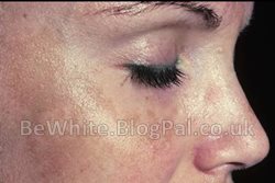 Effective skin whitening for Ghanaian men