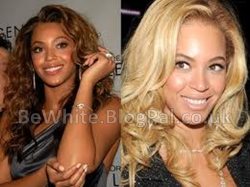 Bleaching cream for Zimbabwe people