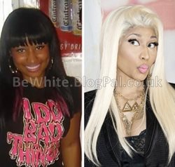Bleaching skin for Somali