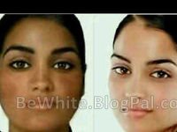 Face whitening for Jamaican men