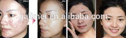 Skin whitening facial for Filipino