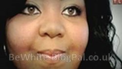 Whitening dark skin creams for Congo