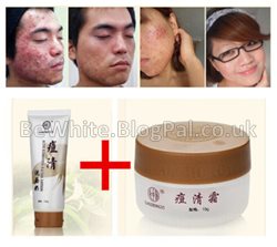 Whitening facial cream for Somalia people
