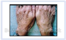 Face whitening for Zambia men