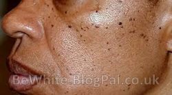 Whitening cream best for Uganda people