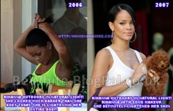 Best whitening face cream for Black Trinidadians woman
