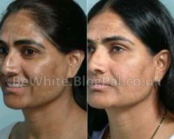 Whitening cream for South African women