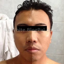 Best skin whitening creams for Zimbabwe