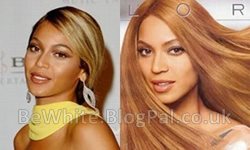 Hyperpigmentation cream for Black woman