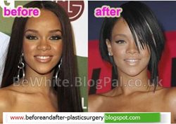 Body skin whitening cream for Zambia women